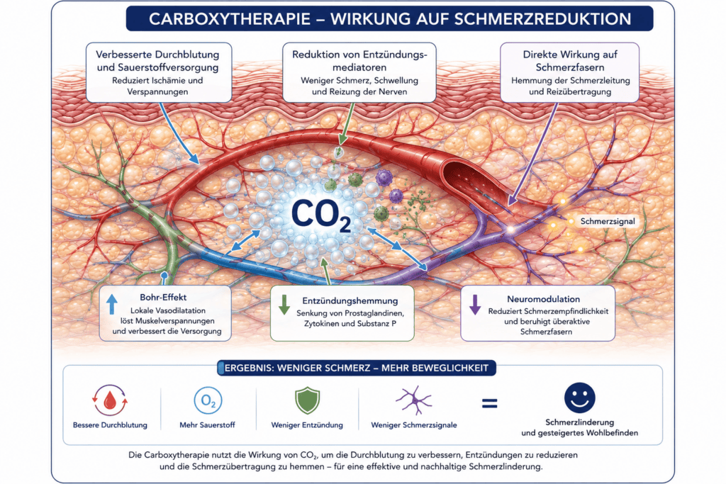 Carboxytherapie – Regeneration der extrazellulären Matrix und des interstitiellen Bindegewebes 1 Carboxytherapie Schmerztherapie