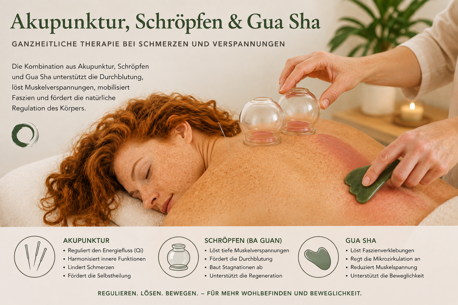 Akupunktur, Schröpfen und Gua Sha – die kraftvolle Kombination bei Schmerzen des Bewegungsapparates 1 Kombination von Akupunktur und GuaSha